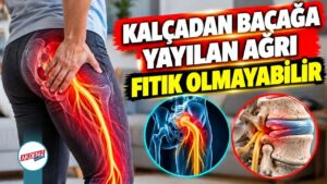 Kalçadan Bacağa Yayılan Ağrı Fıtık Olmayabilir – Akdeniz Gazetesi